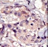 PDGFRA / PDGFR Alpha Antibody (aa1048-1077)