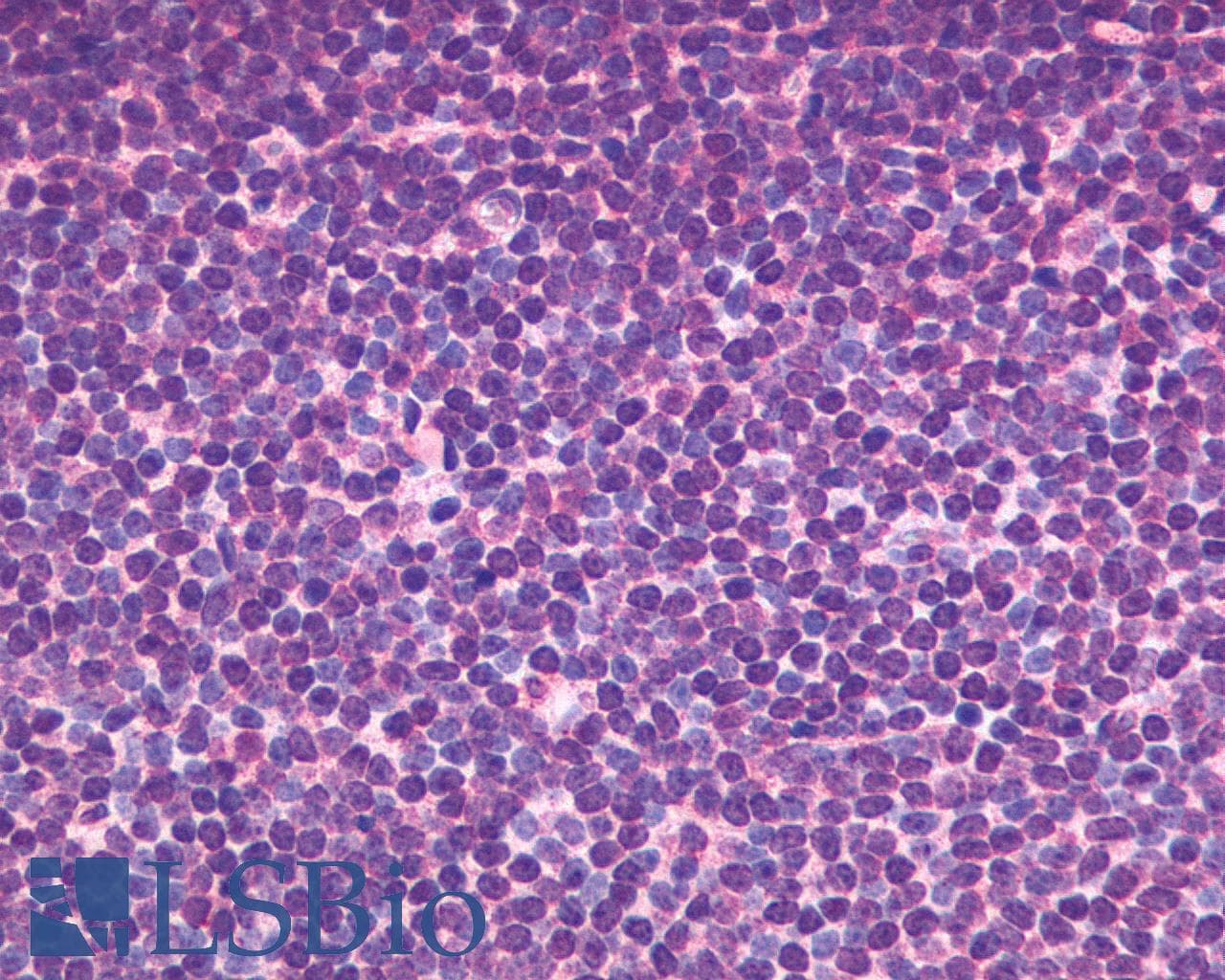 IHC-plus™ CXCR5 Antibody (Cytoplasmic Domain)