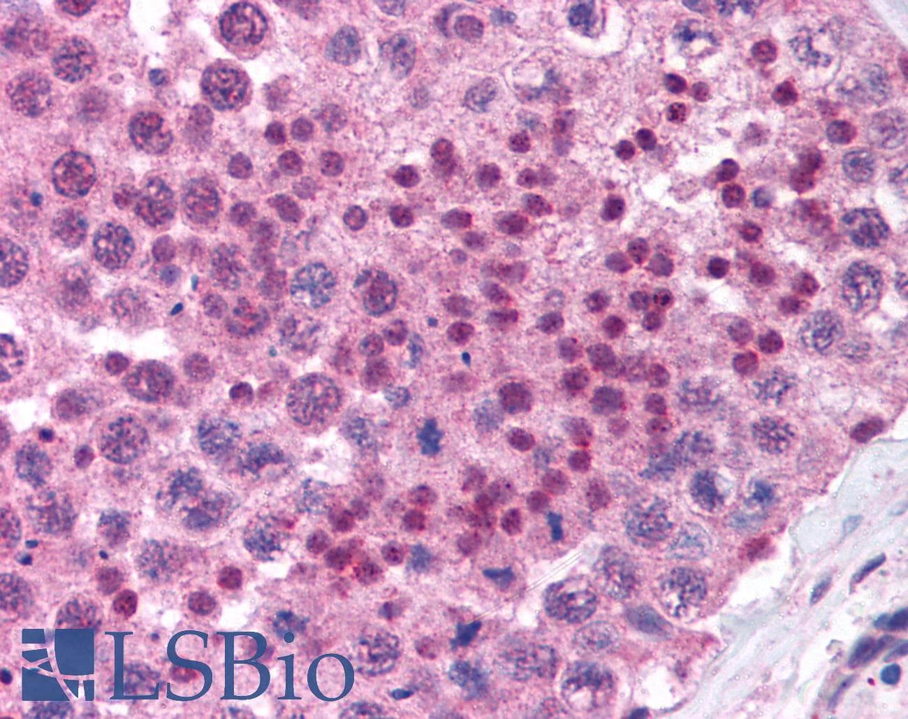 IHC-plus™ MAGEB1 Antibody (aa139-154)