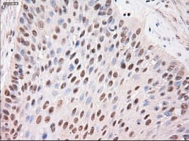 Monoclonal Mouse anti-Human STAT4 Antibody (clone OTI2A2, IHC, WB)