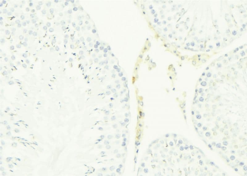 LL37 / Cathelicidin Antibody