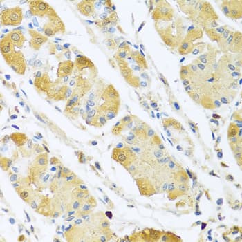 C4BPB / C4BP Beta Antibody
