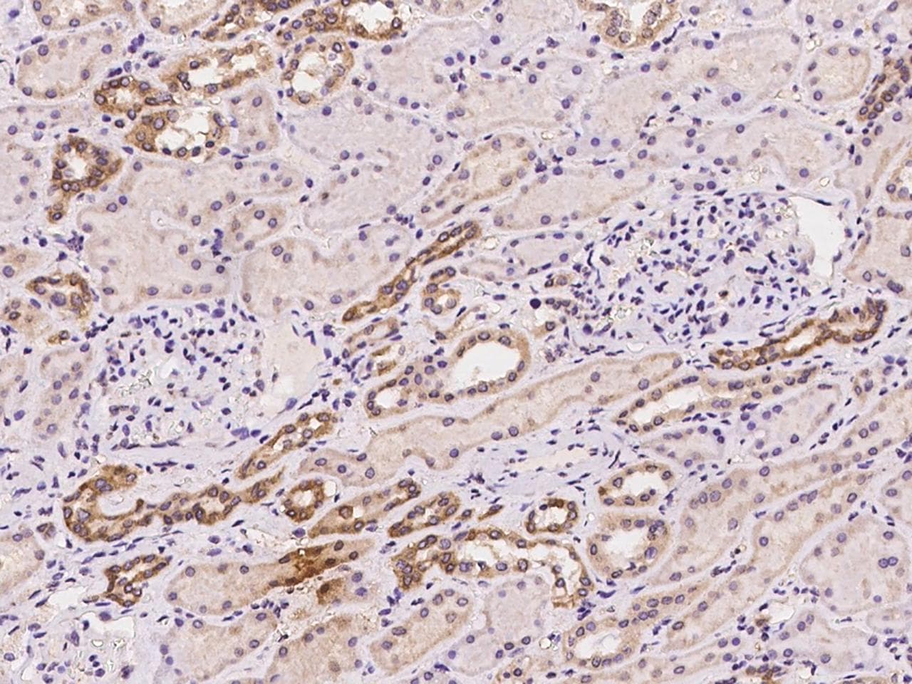 Polyclonal Rabbit anti-Human GP78 / AMFR Antibody (IHC)