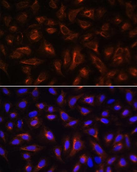 ARL13B Antibody