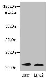 LRRC20 Antibody