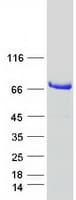 Human GLCNE / GNE Protein (Recombinant Myc-DDK (Flag))