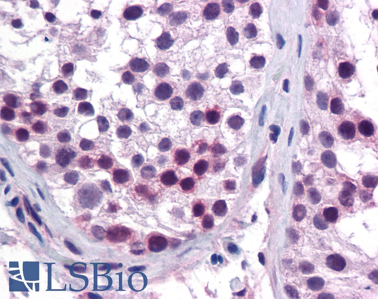 HOXA5 Antibody (aa143-192)