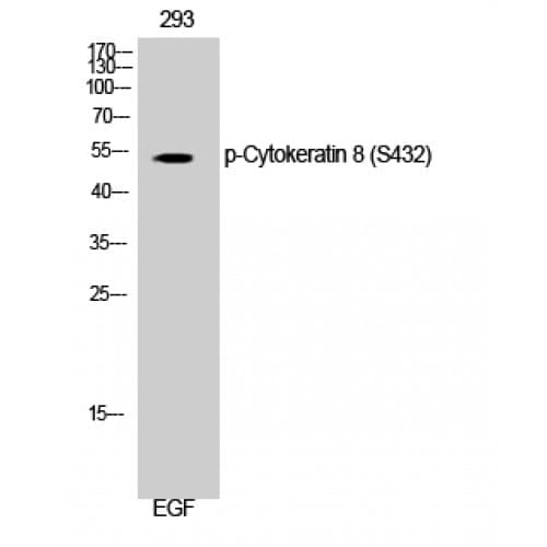 Polyclonal Rabbit anti-Human KRT8 / CK8 / Cytokeratin 8 Antibody (370-450 aa, IHC, IF, WB)