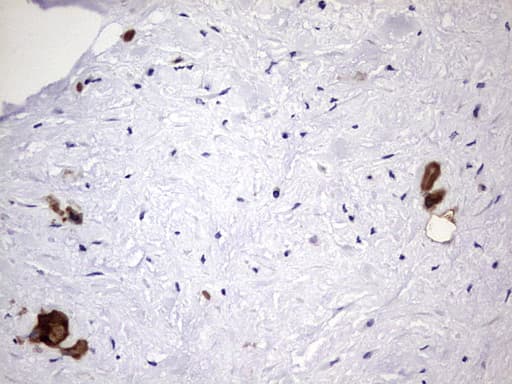 LGALS3 / Galectin 3 Antibody (clone OTI1C7)