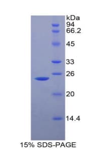 Rat FBLN2 / Fibulin 2 Protein (Recombinant His)