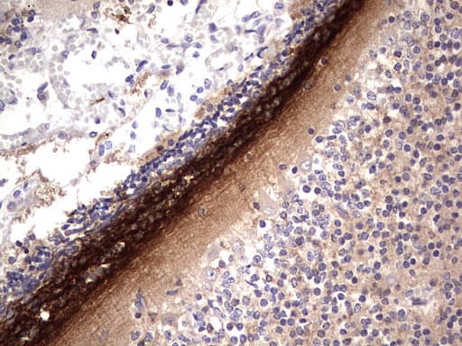 GLI / GLI1 Antibody (aa1-410, clone OTI2D5E2)
