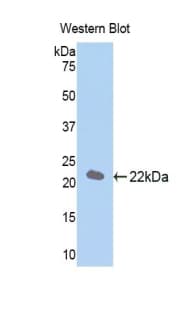 NFKBIA / IKB Alpha / IKBA Antibody (aa74-247)