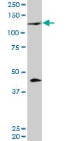 Monoclonal Mouse anti-Human BLIMP1 / PRDM1 Antibody (clone 2B10, WB)