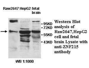ZNF215 Antibody (aa1-252)
