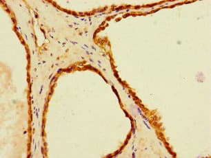 LACTB2 Antibody