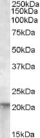 IHC-plus™ NRAS / N-ras Antibody (aa167-179)
