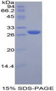 Mouse LAG3 Protein (Recombinant His-T7)
