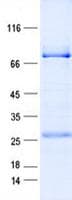 Human CSNK1G2 / CKI-Gamma 2 Protein (Recombinant GST, N-terminus + His, C-terminus)