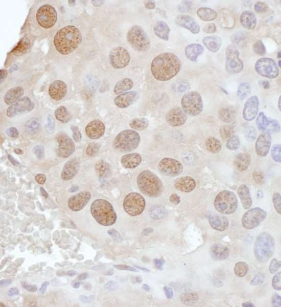PCYT1A / CCT Alpha Antibody (aa317-367)