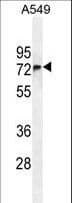 FBXO24 Antibody (aa118-145)