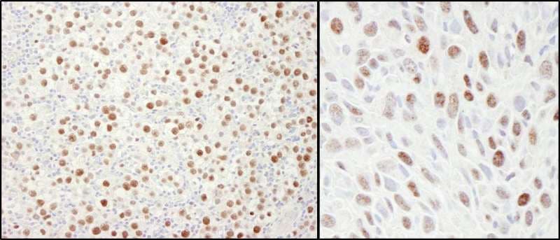 MCM4 Antibody (aa750-800)