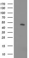 IHC-plus™ PIP4K2A / PIPK Antibody (clone 3D3)