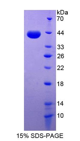 Human DSC2 / Desmocollin 2 Protein (Recombinant His-S)