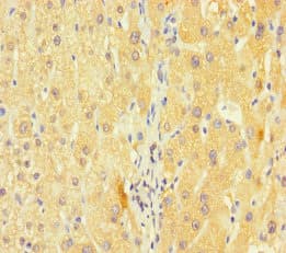 KCNA6 / Kv1.6 Antibody
