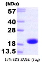 Human TNNC2 Protein (Recombinant)