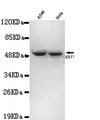 Monoclonal Mouse anti-Human KRT7 / CK7 / Cytokeratin 7 Antibody (N-Terminus, IF, WB)
