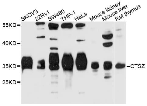 Polyclonal Rabbit anti-Human CTSZ / Cathepsin Z Antibody (WB)
