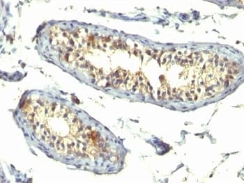 TGFA / TGF Alpha Antibody (aa34-43, clone TG86 + P/T1, Azide-free, BSA-free)