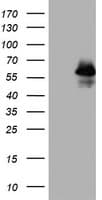 Monoclonal Mouse anti-Human TP53 / p53 Antibody (clone OTI7E2, WB)