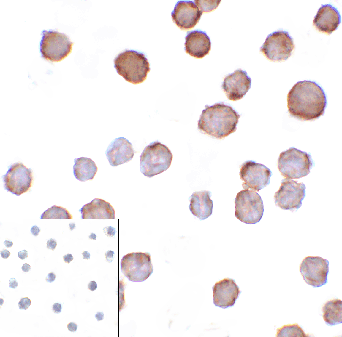 CD276 / B7-H3 Antibody (clone 10G6)