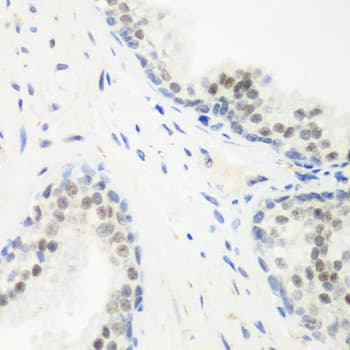 Polyclonal Rabbit anti-Human PPAN Antibody (IHC, IF, WB)