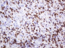 Monoclonal Mouse anti-Human CD2 Antibody (clone OTI3E11, IHC, WB)
