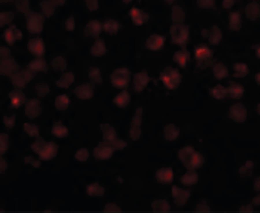 IHC-plus™ Polyclonal Rabbit anti-Human NDUFAF2 / NDUFA12L Antibody (IHC, IF, WB)