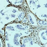 PathPlus™ Vimentin Antibody