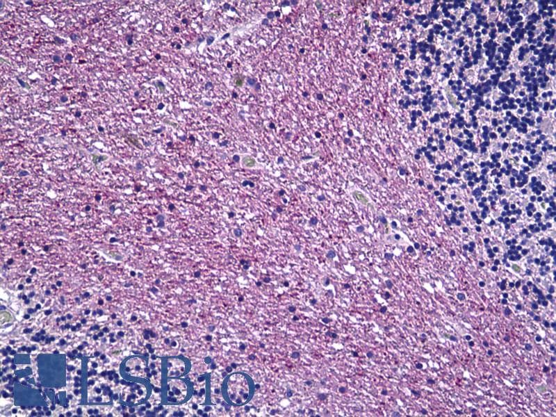 IHC-plus™ Polyclonal Rabbit anti-Human ARHGEF9 / Collybistin Antibody (aa399-448, IHC)