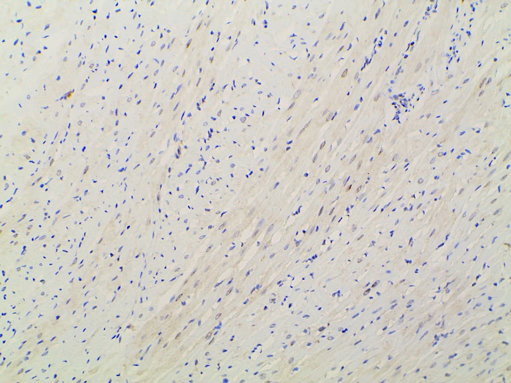 EFNB2 / Ephrin B2 Antibody