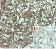 ANGPTL7 / CDT6 Antibody (clone Kairos 108-4)