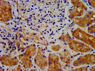 Polyclonal Rabbit anti-Human DTNBP1 / Dysbindin Antibody (IHC, IF)
