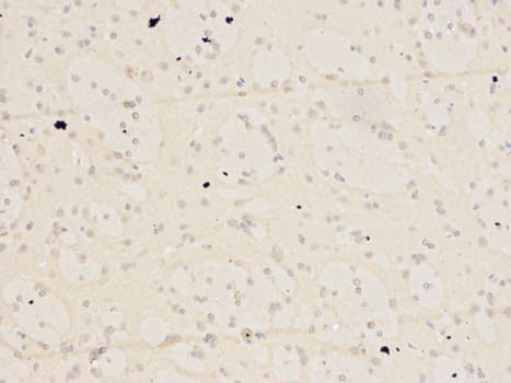 IHC-plus™ KPNA2 / Importin Alpha 1 Antibody