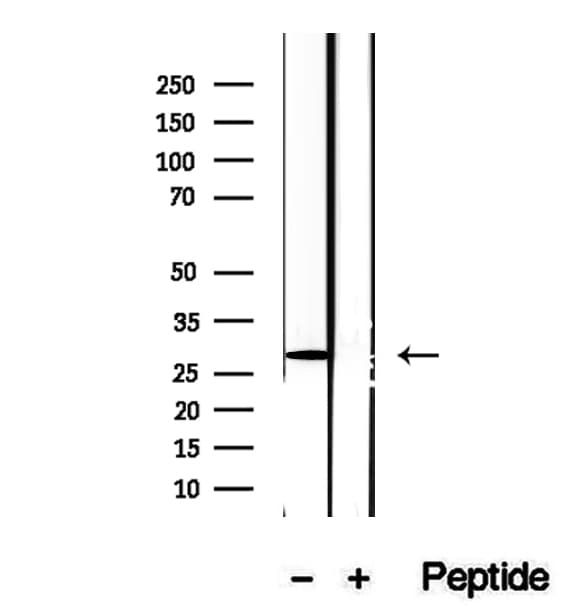 DIO1 / TXDI1 Antibody