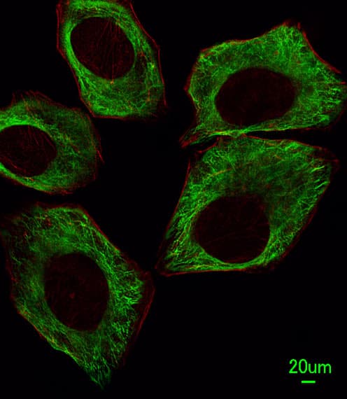 PathPlus™ TUBB / Beta Tubulin Antibody