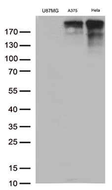 Monoclonal Mouse anti-Human L1CAM Antibody (clone UMAB48, IHC, IF, WB)