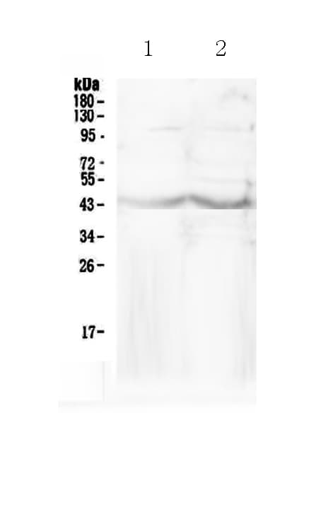 CHI3L1 / YKL-40 Antibody
