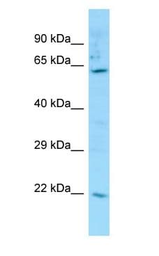 Polyclonal Rabbit anti-Human Carboxylesterase 3 / CES3 Antibody (aa260-309, WB)