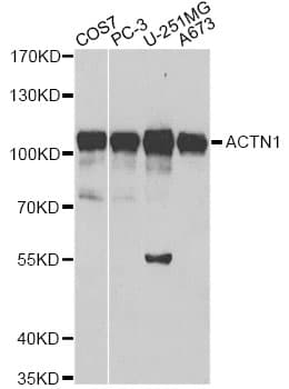 IHC-plus™ ACTN1 Antibody