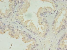 ACAA1 Antibody (aa27-331)